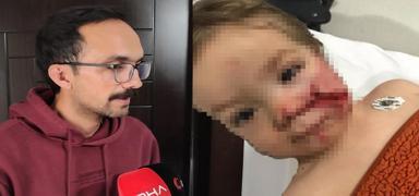 Ankara'da 2 k���k �ocu�a pitbull sald�rd�! Ac�l� baba: En a��r cezay� almalar�n� istiyorum