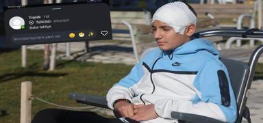 Akran �iddeti sonras� kafatas� titanyumla onar�ld�! Sosyal medya payla��m� pes dedirtti