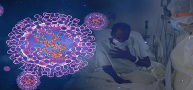 M �i�e�i vir�s� Gana'y� zorluyor: Can kayb� y�kseldi